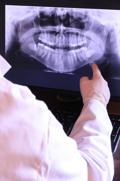 Best Emergency Tooth Extraction in Saxonburg, PA