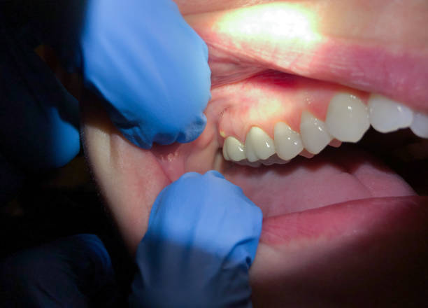 Best Emergency Orthodontic Repairs in Saxonburg, PA